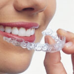 都筑区（都筑ふれあいの丘駅）の歯医者、マサキ歯科クリニックで、マウスピース矯正で話しにくい場合の対処法についての解説