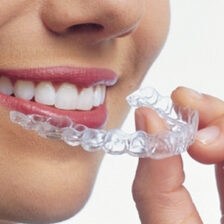 都筑区（都筑ふれあいの丘駅）の歯医者、マサキ歯科クリニックで、マウスピース矯正で話しにくい場合の対処法についての解説