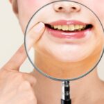 都筑区（都筑ふれあいの丘駅）の歯医者、マサキ歯科クリニックで、ホワイトニングしても歯が白くならない原因を解説