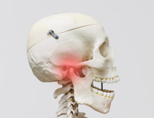 都筑区（都筑ふれあいの丘駅）の歯医者、マサキ歯科クリニックで、顎関節症は治療を受けなくても改善する？セルフケア方法や放置するリスクを解説