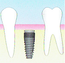 都筑区（都筑ふれあいの丘駅）の歯医者、マサキ歯科クリニックの治療の流れ