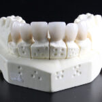 都筑区（都筑ふれあいの丘駅）の歯医者、マサキ歯科クリニックで、オールセラミックとジルコニアの違いは？審美性と強度の比較を解説