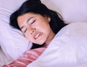 歯ぎしり用マウスピースの寿命は？交換時期や長持ちさせる方法を解説